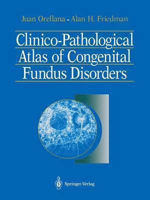 bokomslag Clinico-Pathological Atlas of Congenital Fundus Disorders