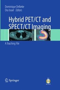 bokomslag Hybrid PET/CT and SPECT/CT Imaging