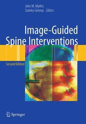 bokomslag Image-Guided Spine Interventions