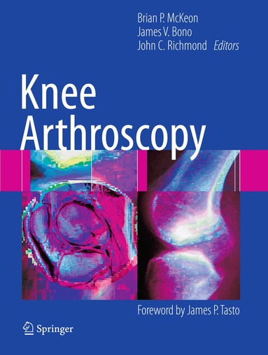 Brian McKeon, James V. Bono, John C. Richmond - Knee Arthroscopy, Häftad