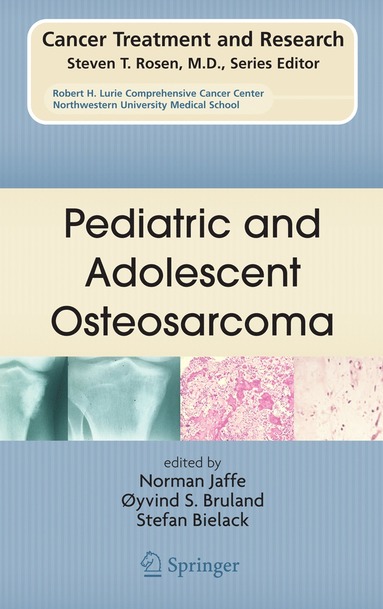 bokomslag Pediatric and Adolescent Osteosarcoma