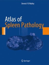 bokomslag Atlas of Spleen Pathology
