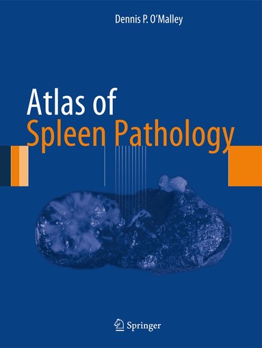 Dennis P. O'Malley - Atlas of Spleen Pathology, Inbunden