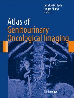 Atlas of Genitourinary Oncological Imaging 1