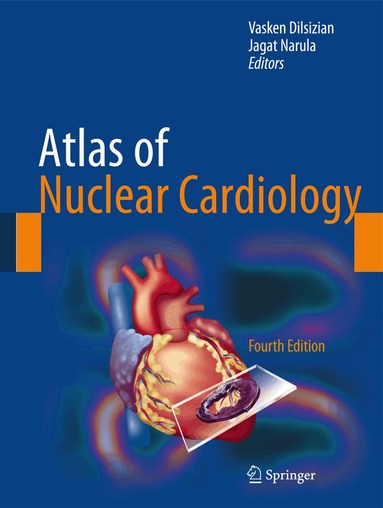 Vasken Dilsizian, Jagat Narula - Atlas of Nuclear Cardiology, Inbunden