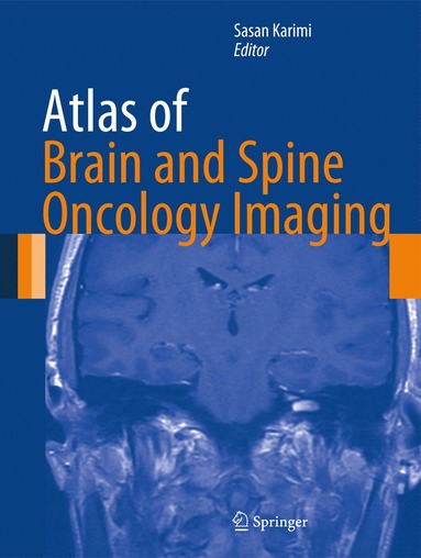 bokomslag Atlas of Brain and Spine Oncology Imaging