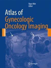 bokomslag Atlas of Gynecologic Oncology Imaging