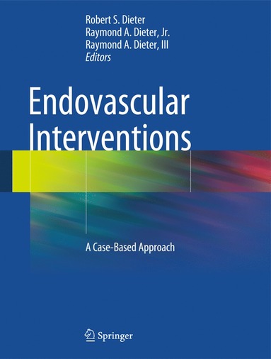 bokomslag Endovascular Interventions