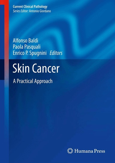 Alfonso Baldi, Paola Pasquali, Enrico P Spugnini - Skin Cancer, Inbunden