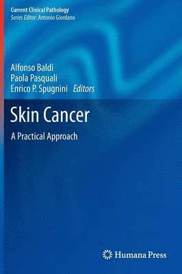 Skin Cancer 1