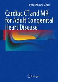 bokomslag Cardiac CT and MR for Adult Congenital Heart Disease