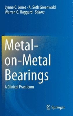 Metal-on-Metal Bearings 1