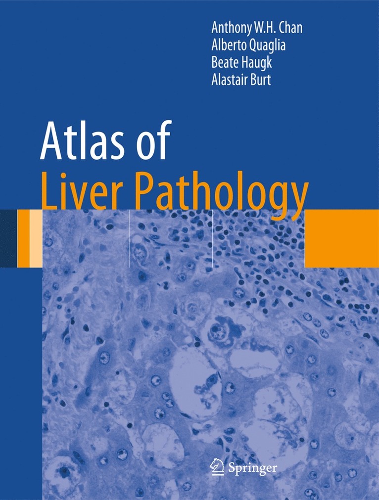 Anthony W.H. Chan, Alberto Quaglia, Beate Haugk, Alastair Burt, Anthony W. H. Chan - Atlas of Liver Pathology, Inbunden