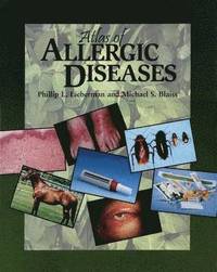 bokomslag Atlas of Allergic Diseases