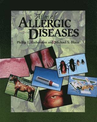 bokomslag Atlas of Allergic Diseases