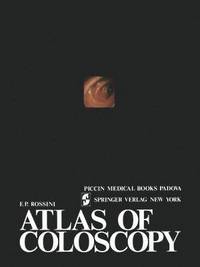 bokomslag Atlas of coloscopy