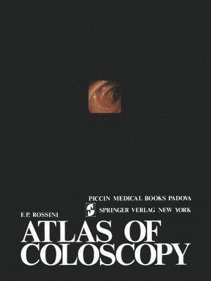 Atlas of coloscopy 1