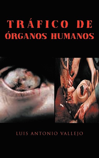 bokomslag Trafico de Organos Humanos