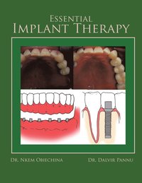 bokomslag Essential Implant Therapy