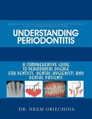 bokomslag Understanding Periodontitis