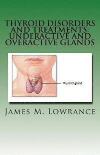 Thyroid Disorders and Treatments: Underactive and Overactive Glands: Understanding Hypothyroid and Hyperthyroid Conditions 1