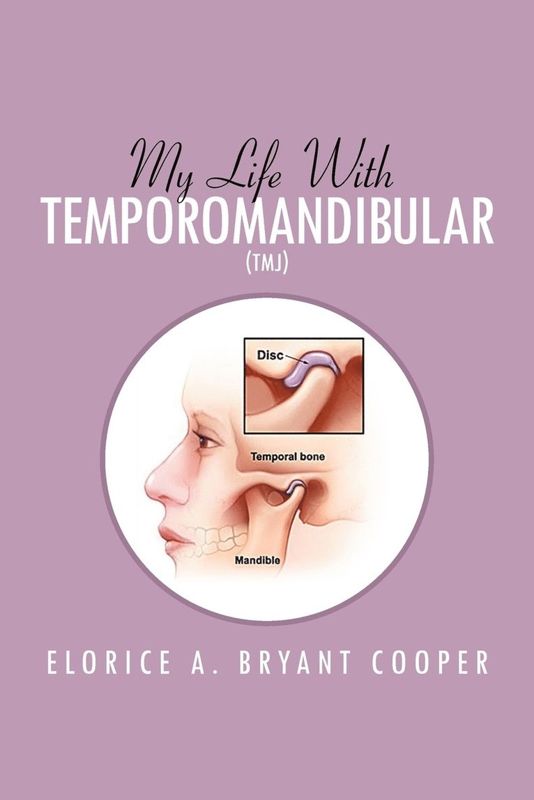 My Life with Temporomandibular (Tmj) 1