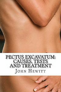 bokomslag Pectus Excavatum: Causes, Tests and Treatment