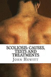 Scoliosis: Causes, Tests and Treatments 1