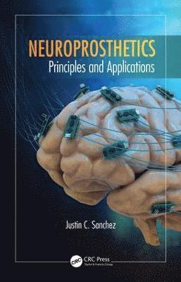 Neuroprosthetics 1