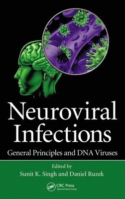 bokomslag Neuroviral Infections