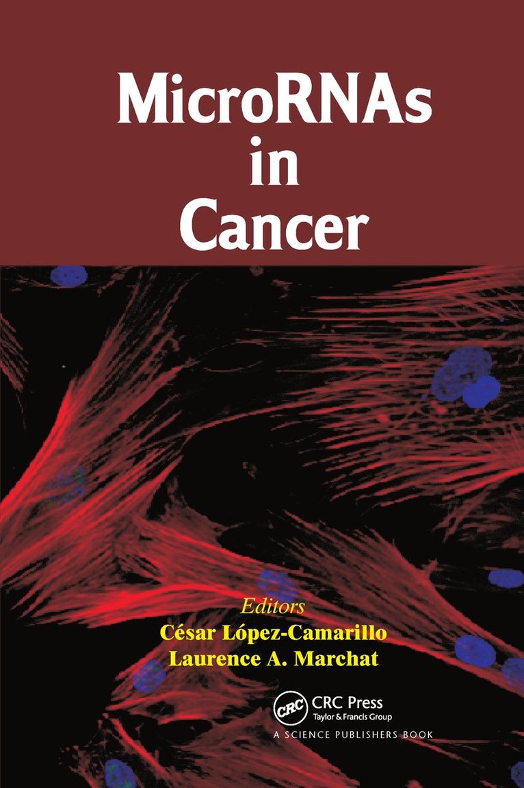 Cesar Lopez-Camarillo, Laurence A. Marchat, Mexico) Lopez-Camarillo, Cesar (Autonomous University of Mexico City - MicroRNAs in Cancer, Inbunden