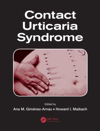 Ana M. Gimenez-Arnau, Howard I. Maibach - Contact Urticaria Syndrome, Inbunden