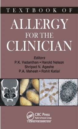 Pudupakkam K. Vedanthan, Harold S. Nelson, Shripad N. Agashe, Mahesh P A, Rohit Katial - Textbook of Allergy for the Clinician, Inbunden
