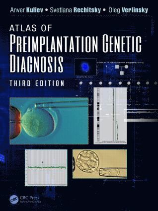 Atlas of Preimplantation Genetic Diagnosis 1