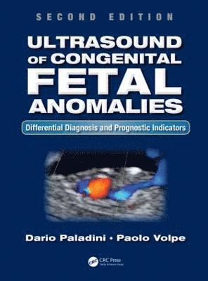 bokomslag Ultrasound of Congenital Fetal Anomalies