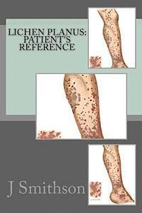 bokomslag Lichen Planus: Patient's Reference