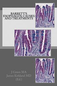 bokomslag Barrett's Esophagus: Causes and Treatments