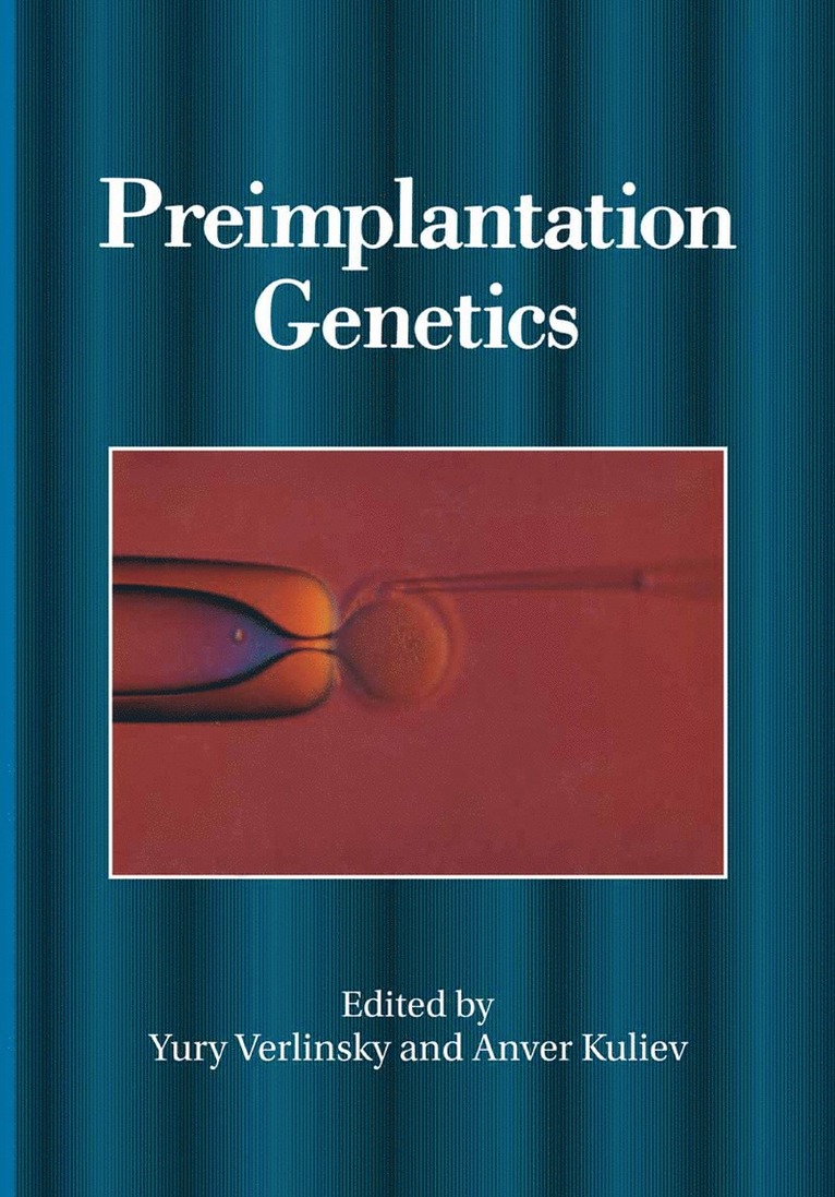 Preimplantation Genetics 1