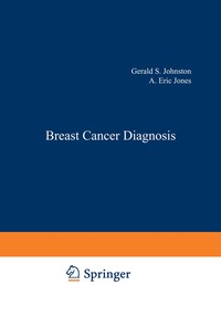 bokomslag Breast Cancer Diagnosis