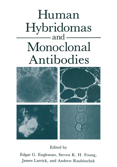 bokomslag Human Hybridomas and Monoclonal Antibodies