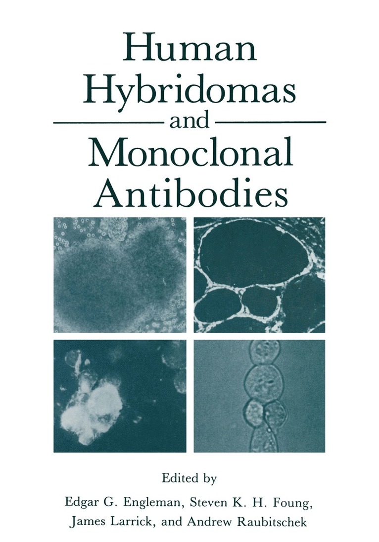 Human Hybridomas and Monoclonal Antibodies 1