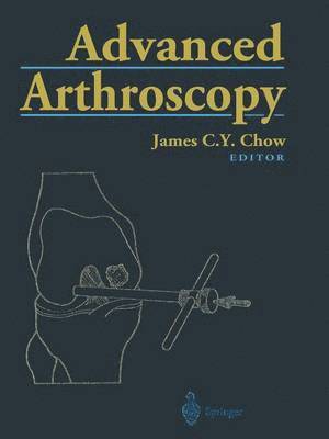 Advanced Arthroscopy 1