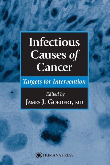 James J. Goedert - Infectious Causes of Cancer, Häftad