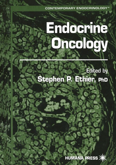 Stephen P. Ethier - Endocrine Oncology, Häftad