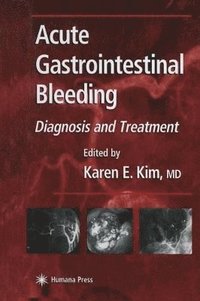 bokomslag Acute Gastrointestinal Bleeding