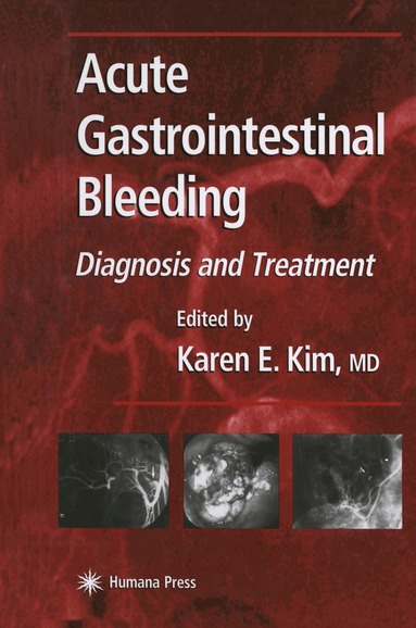 Karen E. Kim - Acute Gastrointestinal Bleeding, Häftad