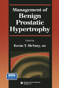 bokomslag Management of Benign Prostatic Hypertrophy