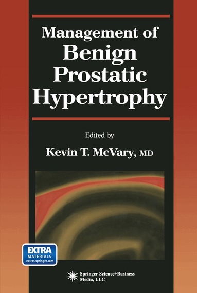 Kevin T. McVary - Management of Benign Prostatic Hypertrophy, Häftad