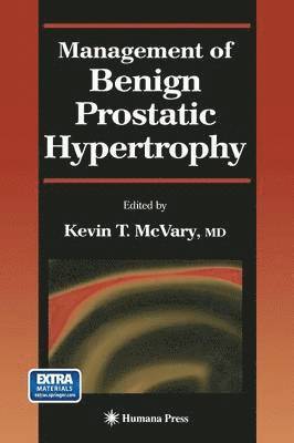 Kevin T. McVary - Management of Benign Prostatic Hypertrophy, Häftad