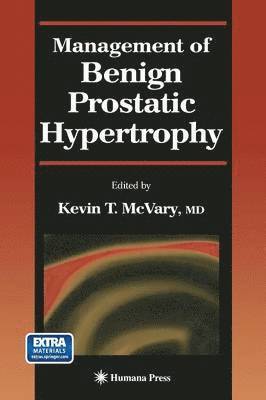 Management of Benign Prostatic Hypertrophy 1